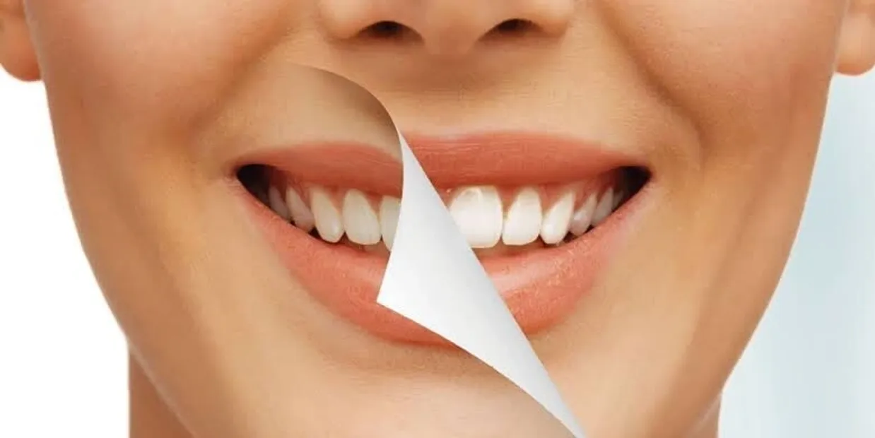 What Is Cosmetic Dentistry and How Can It Transform Your Smile Hertford