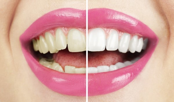 What Early Signs of Oral Cancer Should You Never Ignore Hertford?