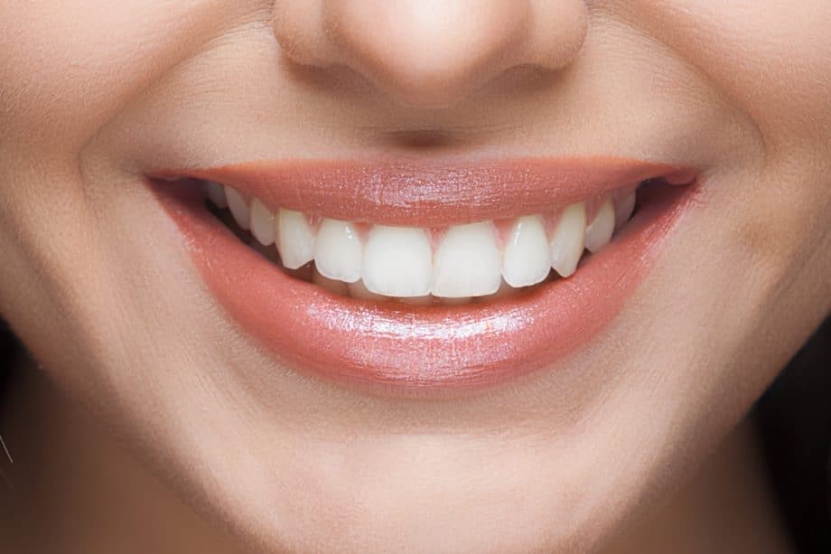 The Impact of White Spots on Oral Health Hertford