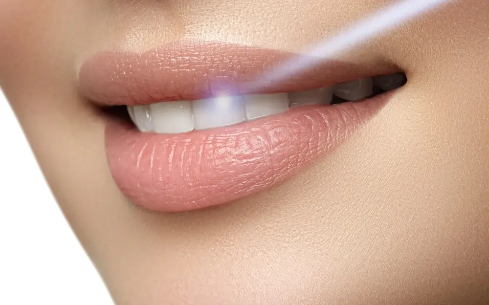 Understanding Teeth Whitening Risks and Results Hertford