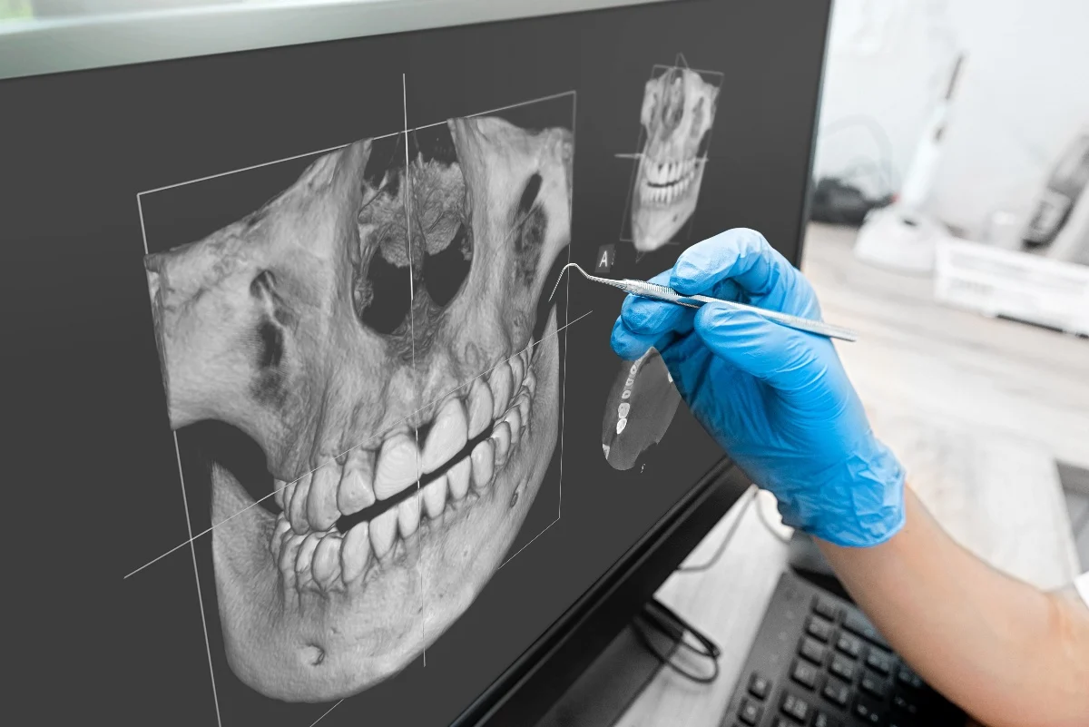 How Is AI Transforming Dental Treatment Planning Hertford?