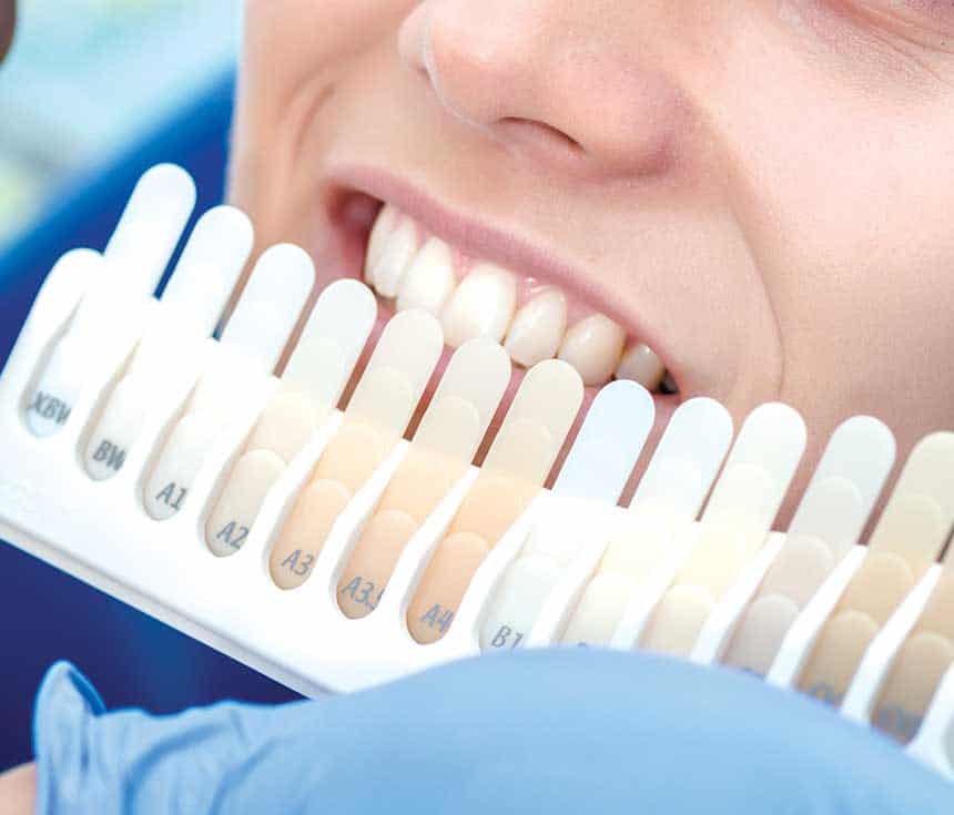 Is Laser Teeth Whitening Worth It for a Brighter, Confident Smile Hertford?