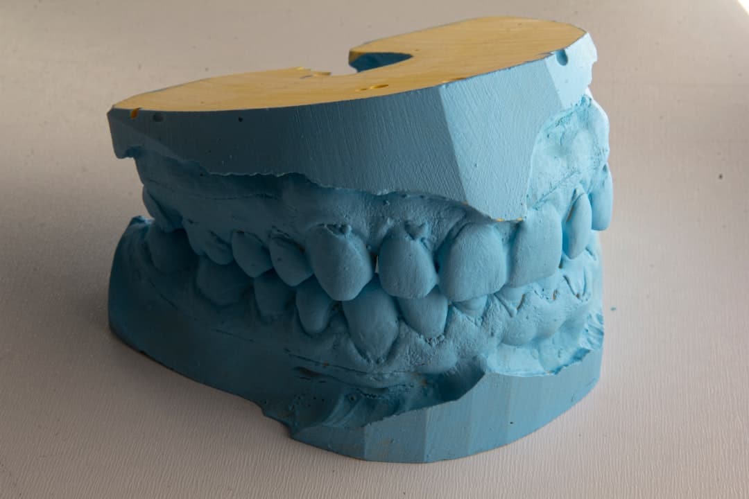 How Do Dental Implants Improve Jawbone Health and Oral Function Hertford?