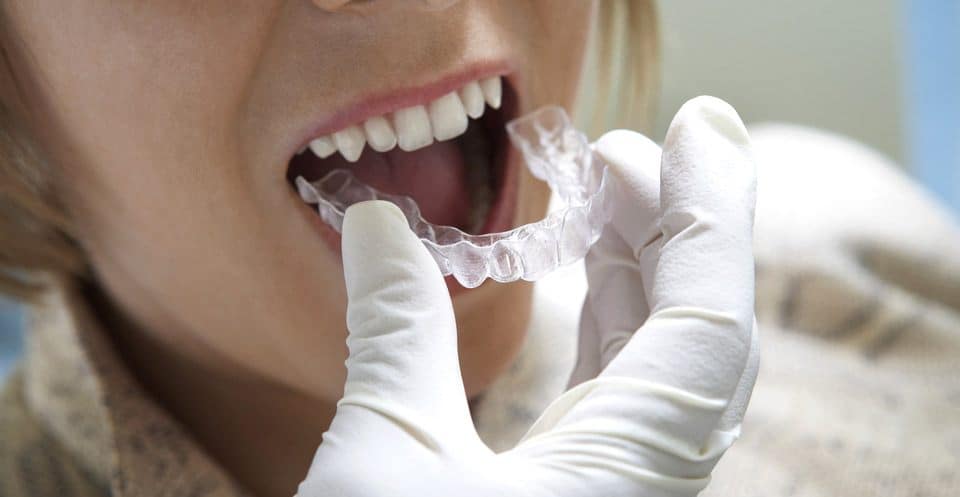 Can Bruxism Affect Your Sleep Quality Hertford