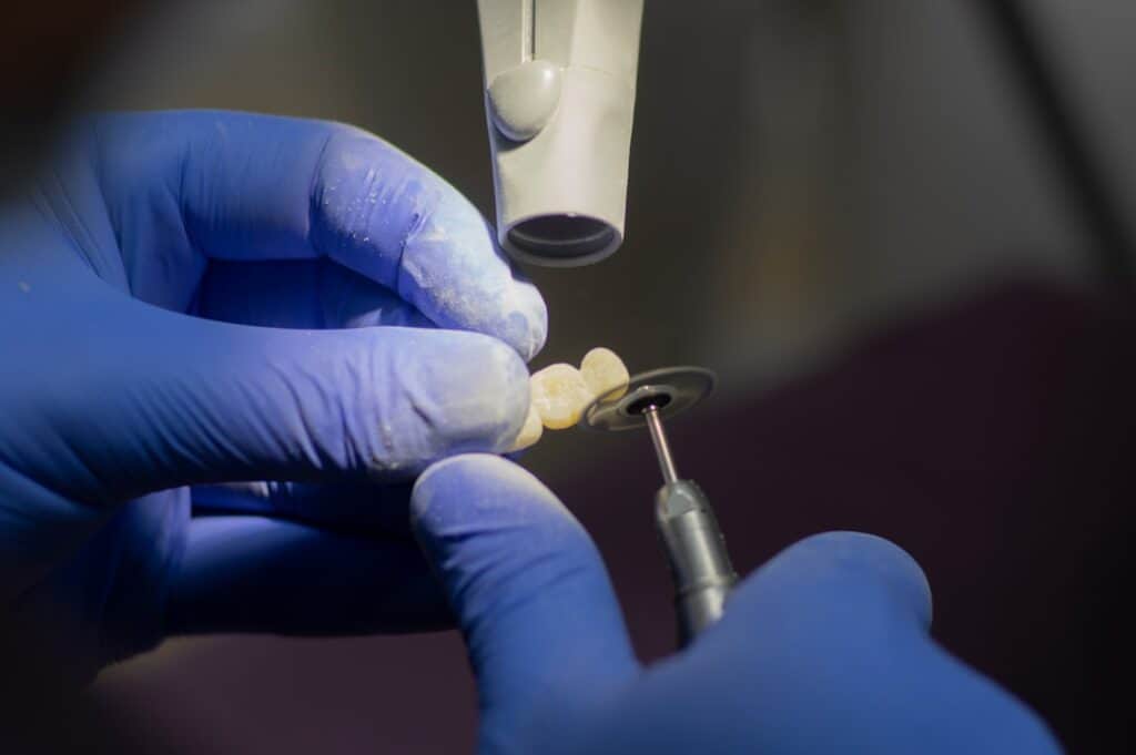 Customised Dental Solutions: Crowns, Aligners, and Implants Hertford