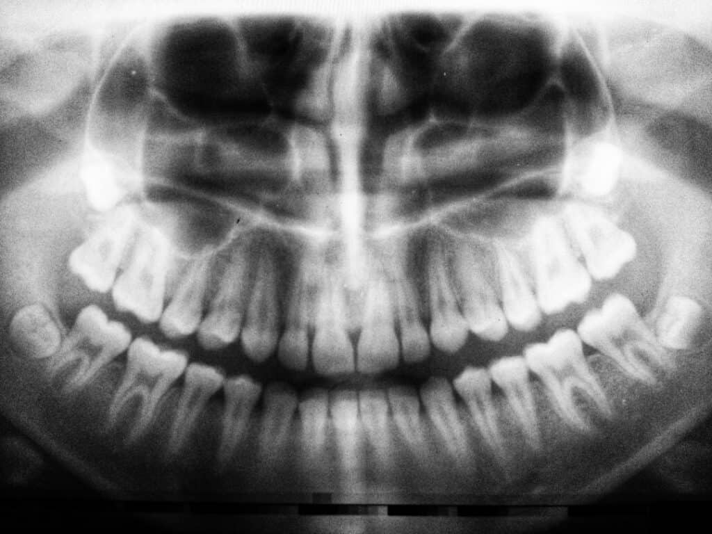 The Future of 3D Printing in Oral Healthcare Hertford